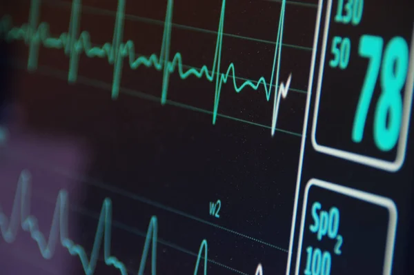 Hastanedeki EKG kalp atış hızı monitörü. EKG elektrokardiyogram, solunum ve SPO2 oksijen doygunluğu tıbbi muayenesi. Hasta kalp monitörü. Kalp atışı görüntüleme çizimi.