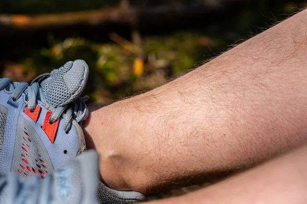 Naturally hairy woman legs. Blue sneakers.