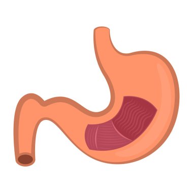 İzole insan mide kesme