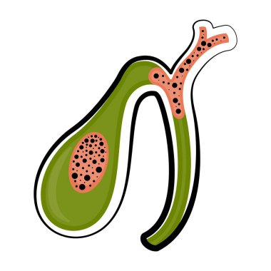 İnsan safra kesesi kesti. Renkli çizimi