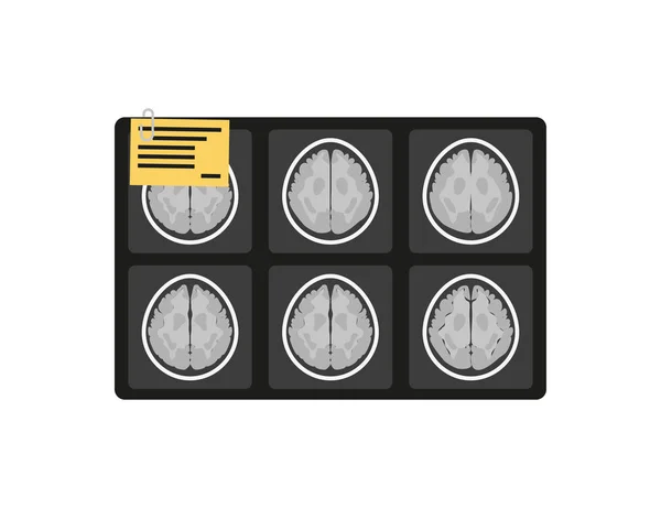Imagen cerebral de rayos X por resonancia magnética en estilo plano — Vector de stock