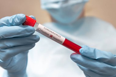 Coronavirus negatif kan testi. Koruyucu giysili doktor, tıbbi maske ve lateks eldivenler içinde kan olan bir tüp tutuyor..