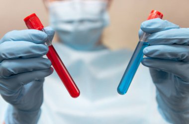Koruyucu giysili doktor, tıbbi maske ve lateks eldivenler kan ve aşı dolu test tüpleri tutuyor. Coronavirus pozitif ve negatif kan testi. 