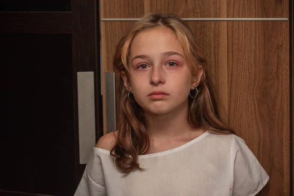 Χαριτωμένο Παιδάκι Κλαίει Κορίτσι Κλαίει Πορτρέτο Ενός Θλιμμένου Κοριτσιού Ετών — Φωτογραφία Αρχείου