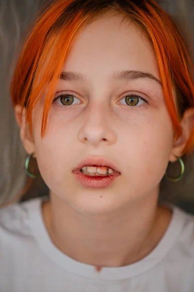 Egy Kislány Törött Szájjal Törött Ajkú Lány Tinédzser Megütötte Ajkát — Stock Fotó