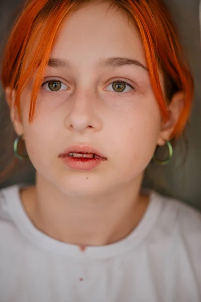 Κοριτσάκι Σπασμένο Χείλος Κορίτσι Σπασμένο Χείλος Έφηβη Χτύπησε Χείλος Της — Φωτογραφία Αρχείου