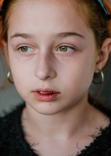 Menina Com Lábio Quebrado Uma Rapariga Com Lábio Partido Adolescente — Fotografia de Stock