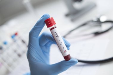Elinde tutan olumlu bir HIV testi teşhis.
