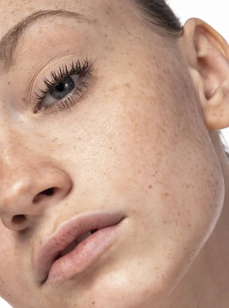 Beautiful Young Face Freckles — Stock Photo, Image
