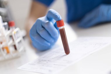 Teşhis kan örnek testi yapıyor.