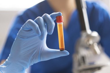 Teşhis kan örnek testi yapıyor.