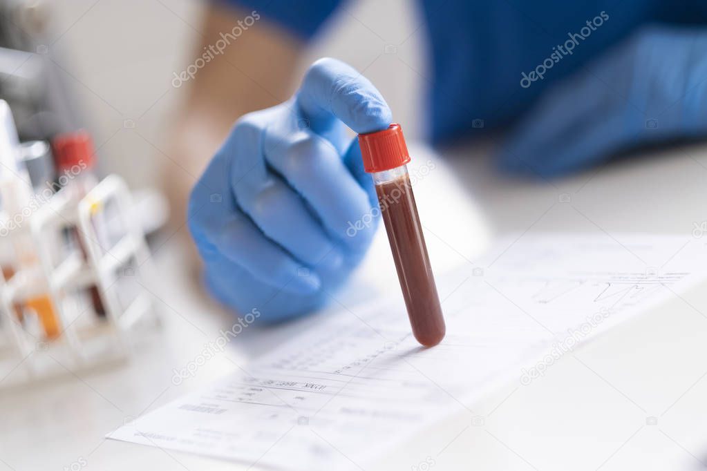 Diagnostician is doing a blood sample test.