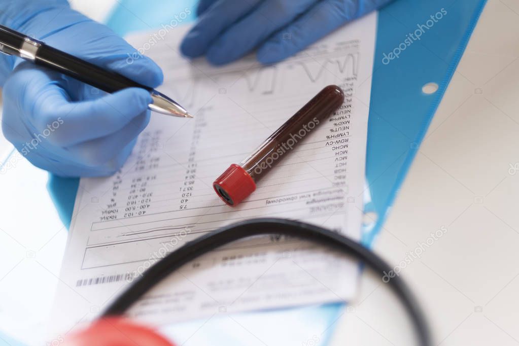 Woman analyzing the results of blood test.