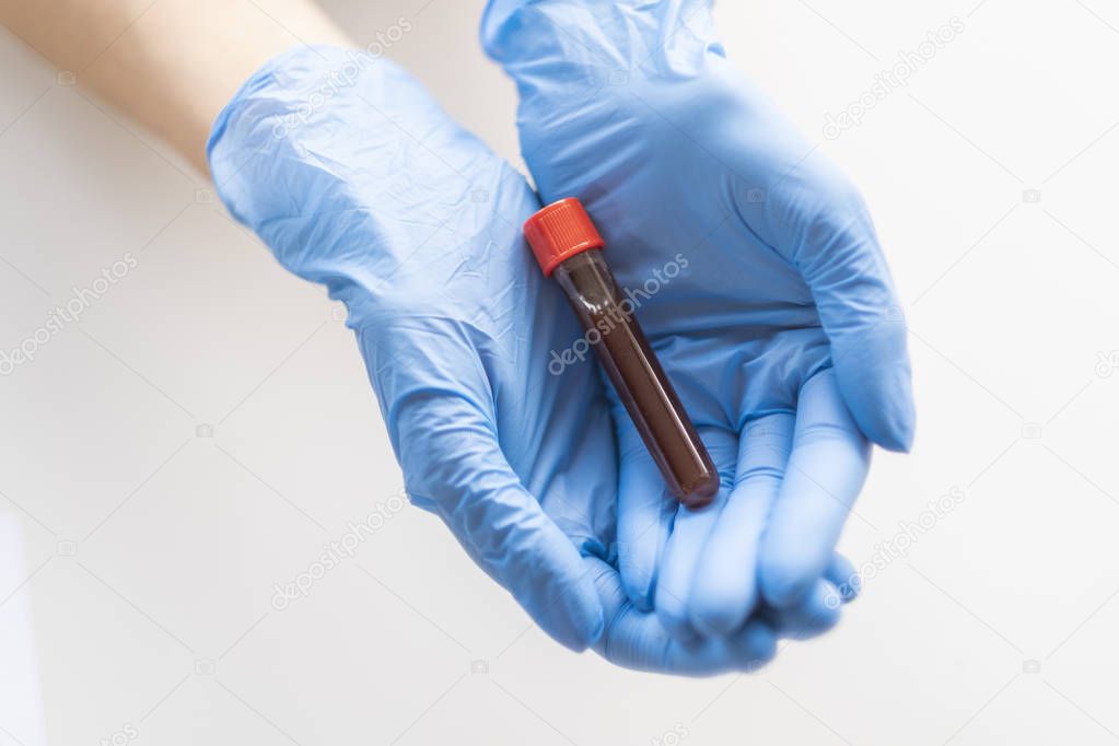 Blood sample on female hands. The blood is a life!