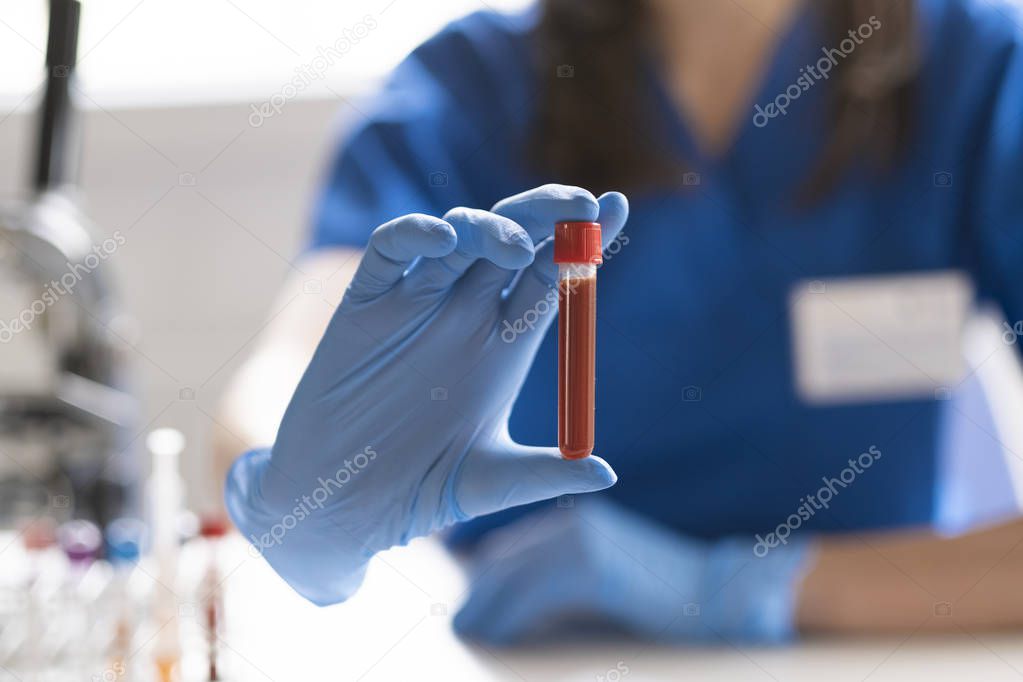 Diagnostician is doing a blood sample test.