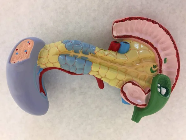 Modelo Anatómico Plástico Que Muestra Páncreas Vesícula Biliar Con Cálculos — Foto de Stock