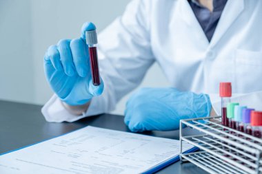 Profesyonel doktorlar koroner virüs enfeksiyonları analizi ve enfeksiyon örneklerini tespit etmek için kan testlerinden virüs testleri yapıyorlar..