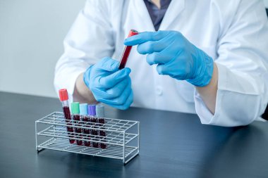 Profesyonel doktorlar koroner virüs enfeksiyonları analizi ve enfeksiyon örneklerini tespit etmek için kan testlerinden virüs testleri yapıyorlar..