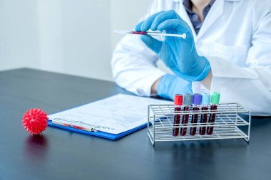 Profesyonel doktorlar koroner virüs enfeksiyonları analizi ve enfeksiyon örneklerini tespit etmek için kan testlerinden virüs testleri yapıyorlar..