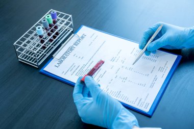Profesyonel doktorlar koroner virüs enfeksiyonları analizi ve enfeksiyon örneklerini tespit etmek için kan testlerinden virüs testleri yapıyorlar..