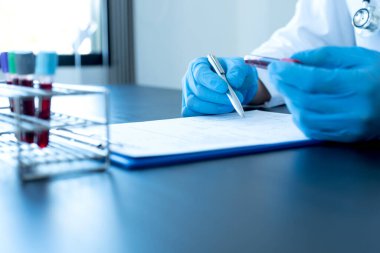 Profesyonel doktorlar koroner virüs enfeksiyonları analizi ve enfeksiyon örneklerini tespit etmek için kan testlerinden virüs testleri yapıyorlar..