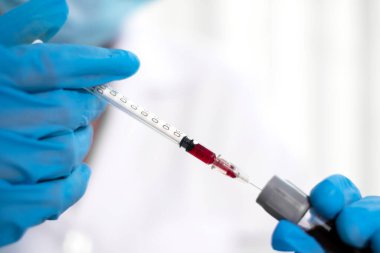 Profesyonel doktorlar koroner virüs enfeksiyonları analizi ve enfeksiyon örneklerini tespit etmek için kan testlerinden virüs testleri yapıyorlar..