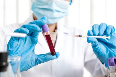 Profesyonel doktorlar koroner virüs enfeksiyonları analizi ve enfeksiyon örneklerini tespit etmek için kan testlerinden virüs testleri yapıyorlar..