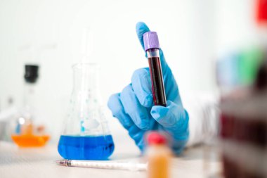 Profesyonel doktorlar koroner virüs enfeksiyonları analizi ve enfeksiyon örneklerini tespit etmek için kan testlerinden virüs testleri yapıyorlar..