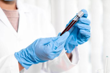 Profesyonel doktorlar koroner virüs enfeksiyonları analizi ve enfeksiyon örneklerini tespit etmek için kan testlerinden virüs testleri yapıyorlar..