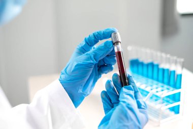 Profesyonel doktorlar koroner virüs enfeksiyonları analizi ve enfeksiyon örneklerini tespit etmek için kan testlerinden virüs testleri yapıyorlar..