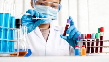 Profesyonel doktorlar koroner virüs enfeksiyonları analizi ve enfeksiyon örneklerini tespit etmek için kan testlerinden virüs testleri yapıyorlar..