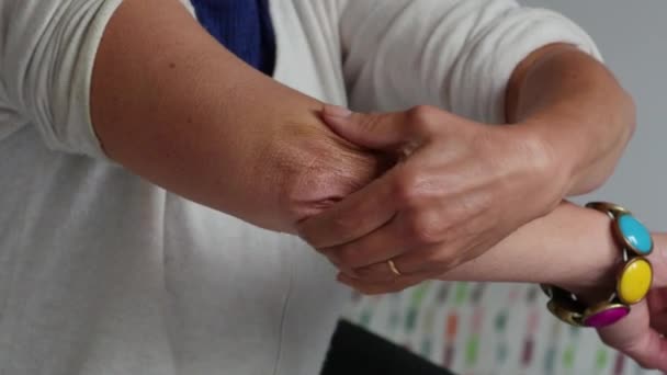 Γυναίκα Έχει Έναν Πόνο Στον Αγκώνα Της — Αρχείο Βίντεο