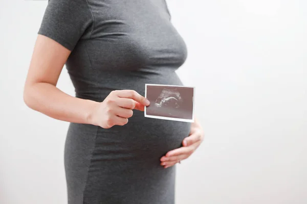 Mujer Embarazada Sostiene Imagen Ultrasonido Del Bebé Vientre Tecnología Médica — Foto de Stock