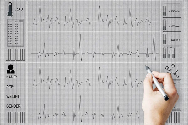 Creative heartbeat sketch — Stock Photo, Image