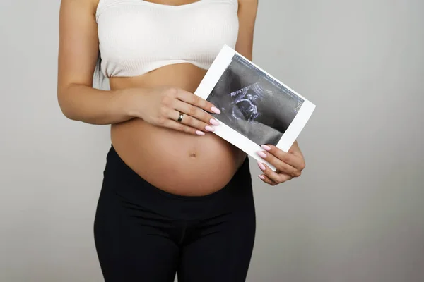Donna incinta che tiene l'immagine ad ultrasuoni del suo bambino su sfondo bianco isolato — Foto Stock