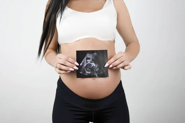 Pregnant brunette woman holding ultrasound picture of her baby with both hands on isolated white background — Stock Photo, Image