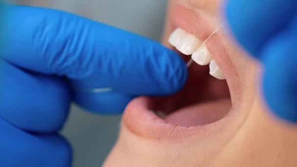 Process of cleaning teeth with dental floss during dentist visit close up — Stockvideo