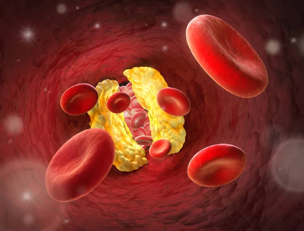 Red blood cells - narrowing of a blood vessel - Erythrozyt 3D illustration