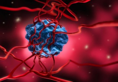 Tumor vernetzt mit Arterien vor rotem Zellhintergrund