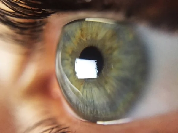 gözde uçak tarayıcı yansıması