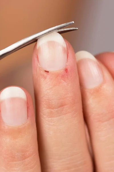 Cutting Your Nail Hand Manicure Shades — Stock Photo, Image