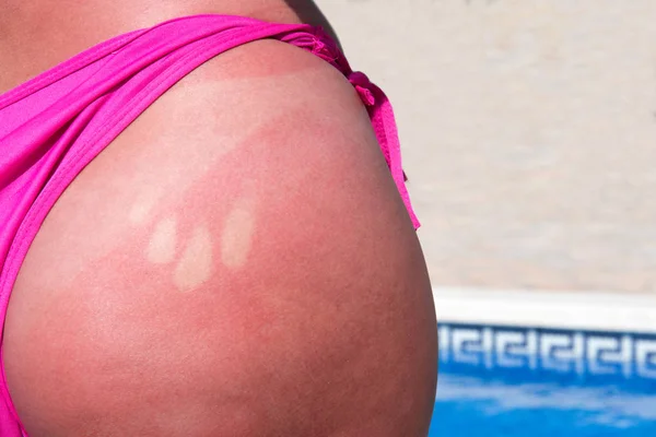 Mujer Con Bronceado Tomando Sol Junto Piscina —  Fotos de Stock