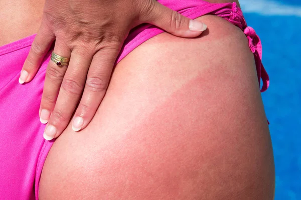 Γυναίκα Τον Ήλιο Κάνοντας Ηλιοθεραπεία Δίπλα Στην Πισίνα — Φωτογραφία Αρχείου