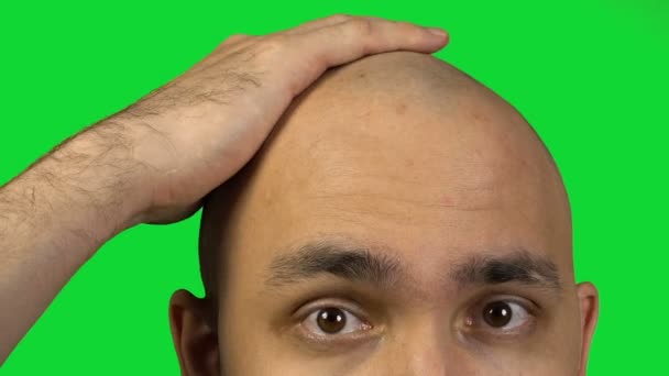 Bald man with half face touching head on green background — Stock Video