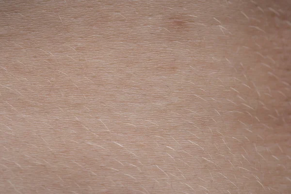 Макро фото молодої рожевої шкіри людини з невусом — стокове фото