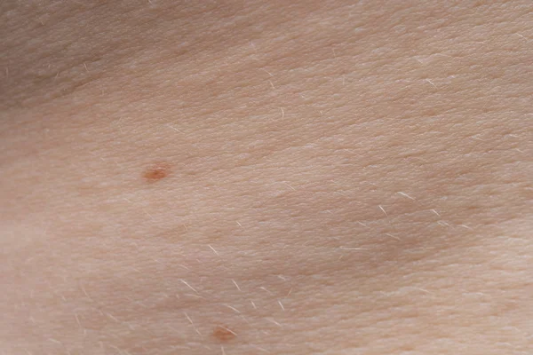 Makro foto av unga rosa människans hud med Nevi — Stockfoto