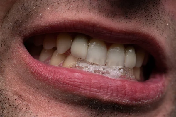 Afbeelding van de man met open mond, met tanden — Stockfoto