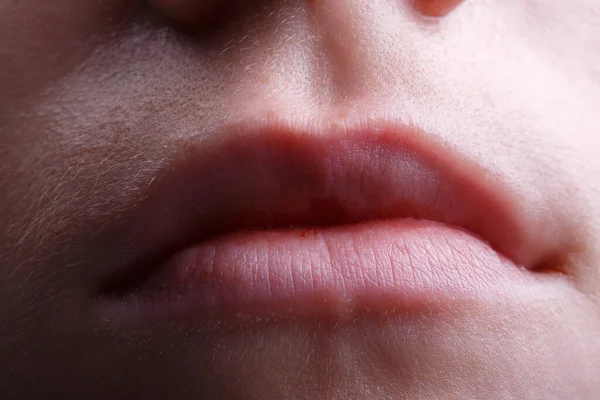 Foto de labios de mujeres jóvenes sin maquillaje, primer plano —  Fotos de Stock