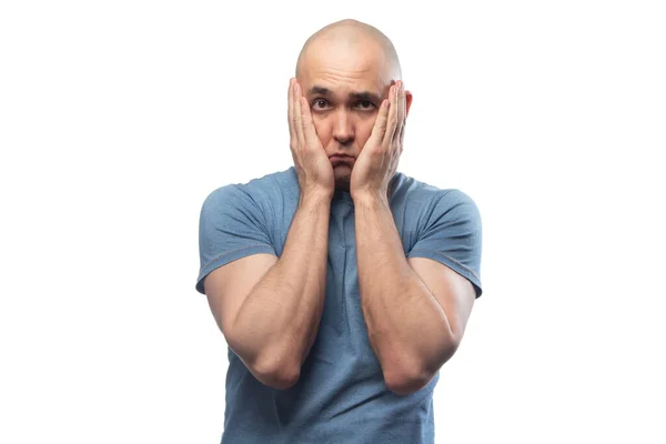 Imagem de jovem careca com problemas na camisa azul tee — Fotografia de Stock