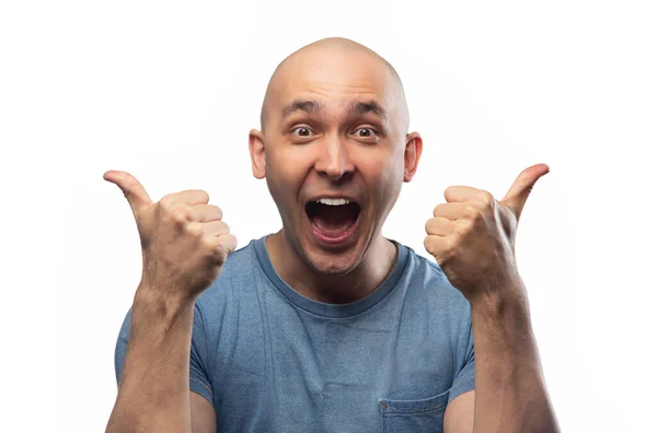 Foto de jovem careca feliz homem em camiseta mostrando polegares — Fotografia de Stock